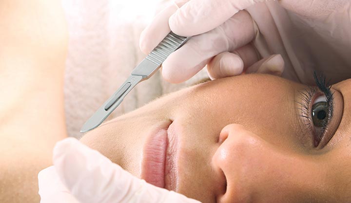 Unveiling Your Natural Glow: The Benefits of Dermaplaning